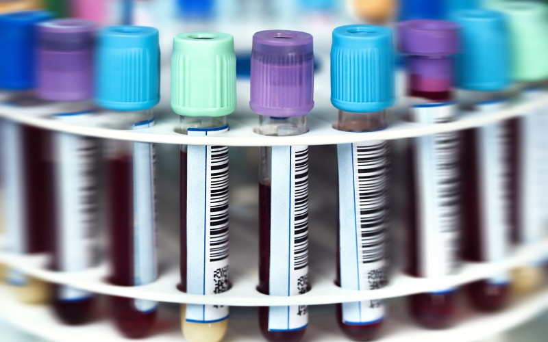 Blood is Thicker than Water - The Infected Blood Scandal: Compensation and Legal Support